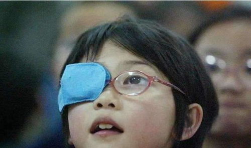 人大代表建议近视者去做激光手术,网友纷纷留言问纳入医保吗