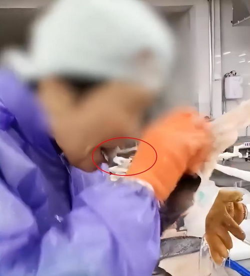 水产加工厂员工用牙给生鱼剥皮,公司回应 临时工为了速度快多挣钱,有发放专门的剥皮工具