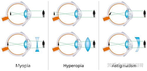 为什么把一支笔贴近眼睛直至模糊,然后视力对焦到笔下面的书上的字,此时眼睛会看到笔周围的文字会扭曲