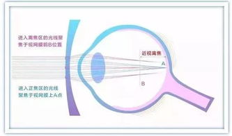 近视防控 豪雅新乐学镜片,一款控制儿童近视的革新产品