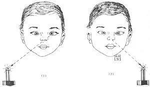 孩子视力不达标需警惕 非近视问题可能是老花、弱视或调节异常