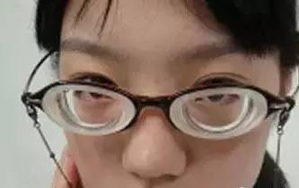 六岁孩童近视高达800度，专家解析儿童近视防控迫在眉睫