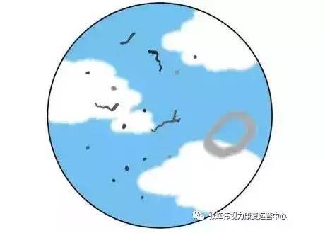 近视弱视散光的孩子有救了！张红伟青少年视力康复中心中山店盛大开业