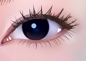 近视与弱视 当近视加深可能引发视力危机